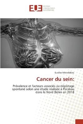 Cancer du sein - Eusèbe Metodakou