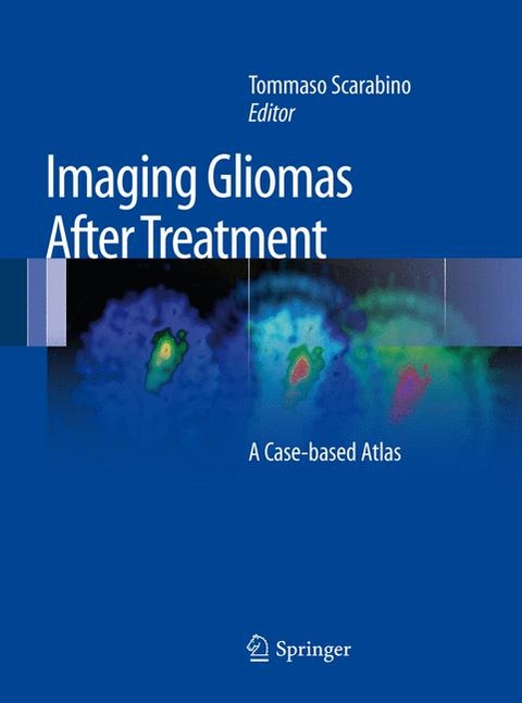 Imaging Gliomas After Treatment - 