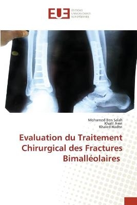 Evaluation du Traitement Chirurgical des Fractures Bimalléolaires - Mohamed Ben Salah, Khalil Amri, Khaled Hadhri