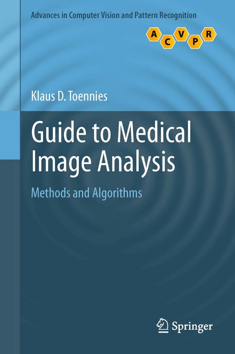 Guide to Medical Image Analysis -  Klaus D. Toennies