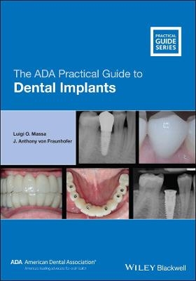 The ADA Practical Guide to Dental Implants - Luigi O. Massa, J. Anthony von Fraunhofer