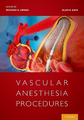 Vascular Anesthesia Procedures - Richard Urman, Alan Kaye