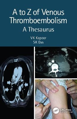 A to Z of Venous Thromboembolism - Vk Kapoor, SK Das