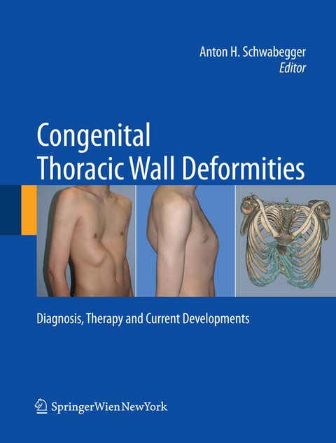 Congenital Thoracic Wall Deformities - 