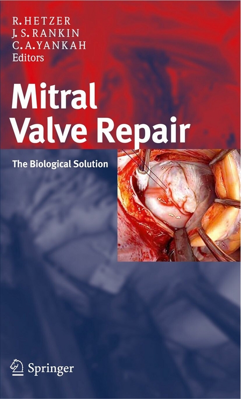 Mitral Valve Repair - 