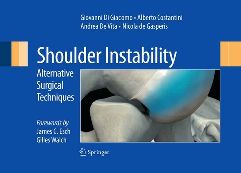 Shoulder Instability - 