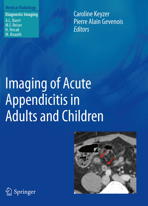 Imaging of Acute Appendicitis in Adults and Children - 