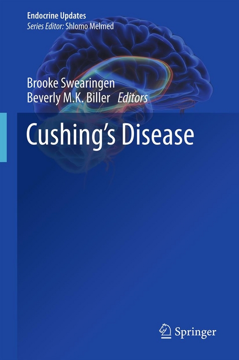 Cushing's Disease - 