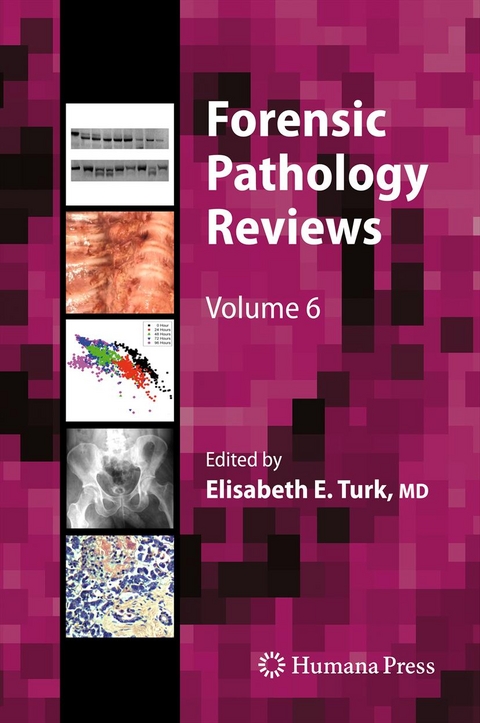 Forensic Pathology Reviews - 