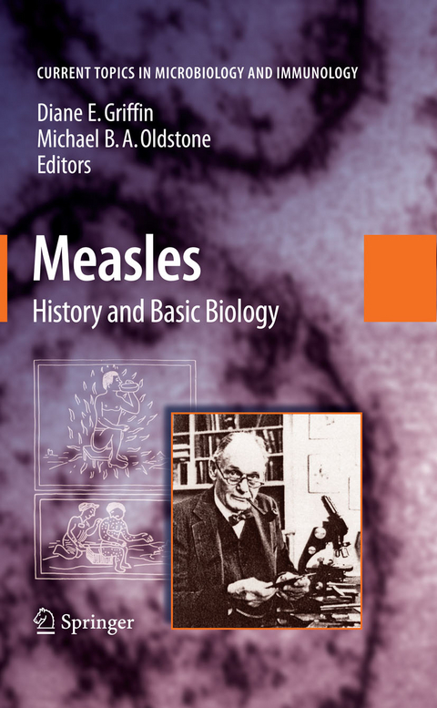 Measles - 