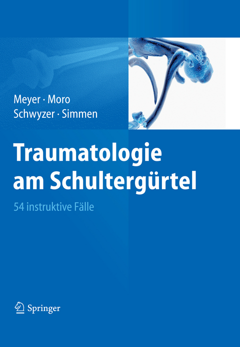 Traumatologie am Schultergürtel - Rainer-Peter Meyer, Fabrizio Moro, Hans-Kaspar Schwyzer, Beat René Simmen
