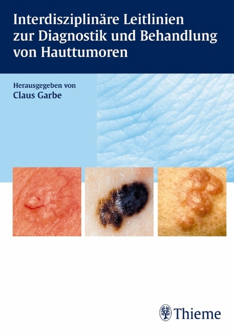 Interdisziplinäre Leitlinien zur Diagnostik und Behandlung von Hauttumoren -  Claus Garbe,  Holger Reimann