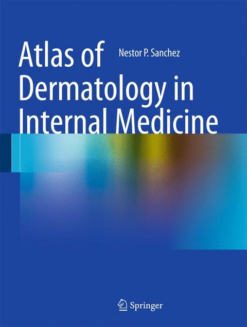 Atlas of Dermatology in Internal Medicine - 