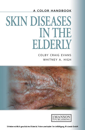 Skin Diseases in the Elderly -  Colby Evans,  Whitney High