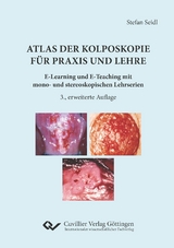 Atlas der Kolposkopie für Praxis und Lehre - Stefan Seidl