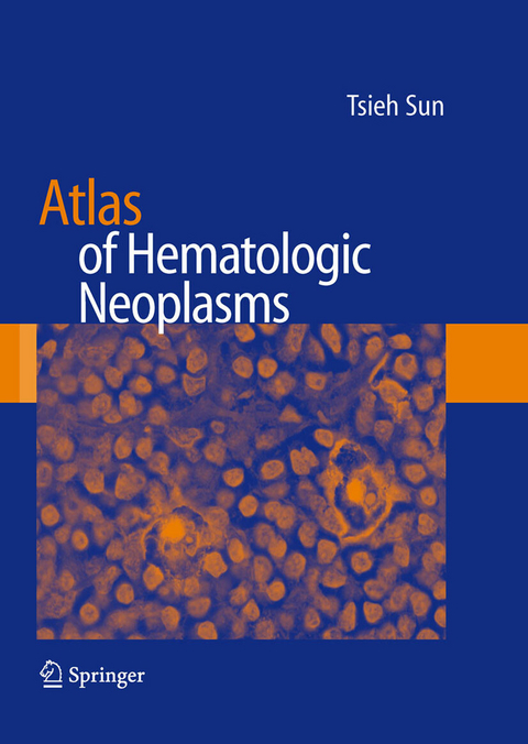 Atlas of Hematologic Neoplasms -  Tsieh Sun