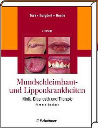 Mundschleimhaut und Lippenkrankheiten - Konrad Bork; Walter Burgdorf; Nikolaus Hoede