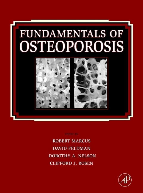 Fundamentals of Osteoporosis - 