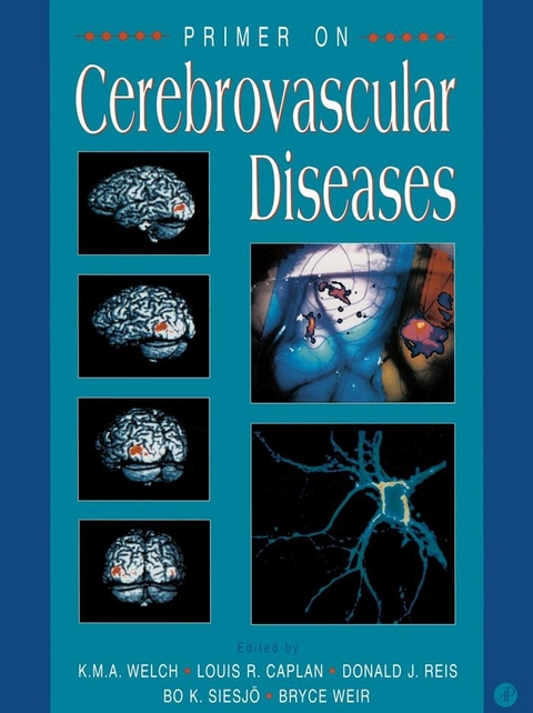 Primer on Cerebrovascular Diseases - 