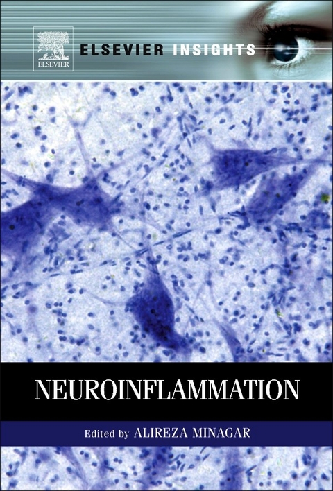 Neuroinflammation - 