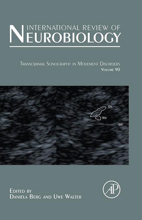 Transcranial Sonography in Movement Disorders - 