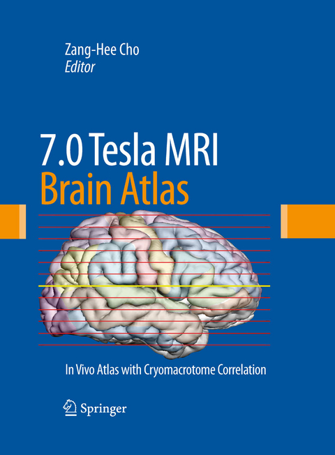 7.0 Tesla MRI Brain Atlas - 