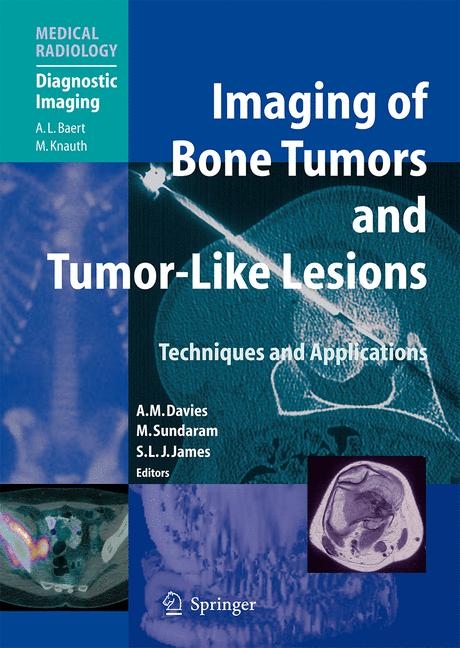 Imaging of Bone Tumors and Tumor-Like Lesions - 