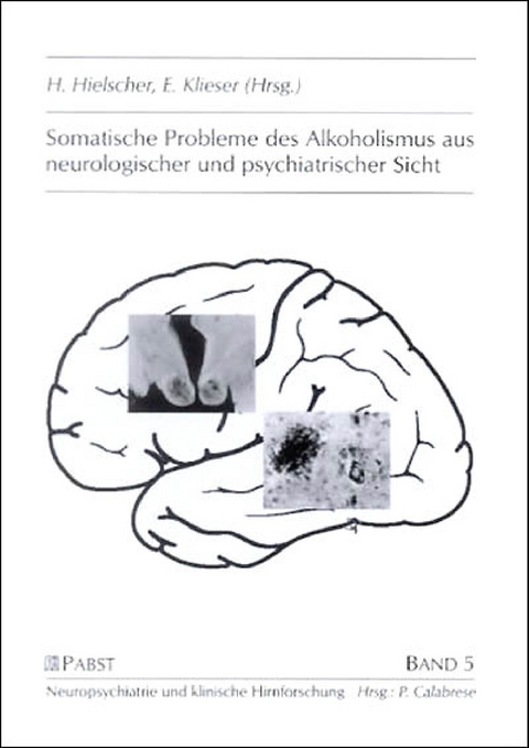 Somatische Probleme des Alkoholismus aus neurologischer und psychiatrischer Sicht - 