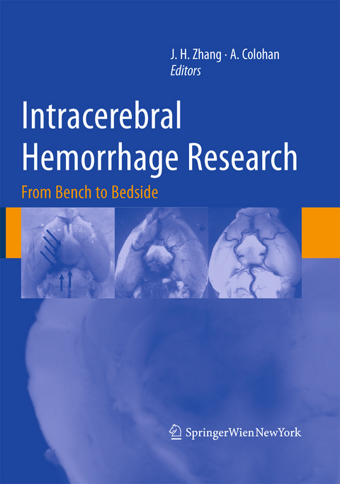 Intracerebral Hemorrhage Research - 