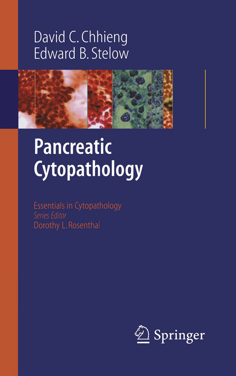 Pancreatic Cytopathology -  David C. Chhieng,  Edward B. Stelow