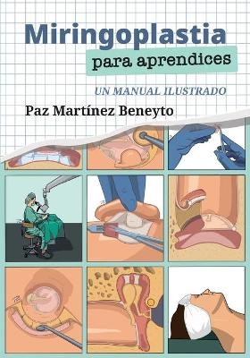 Miringoplastia para aprendices - Paz Martinez Beneyto