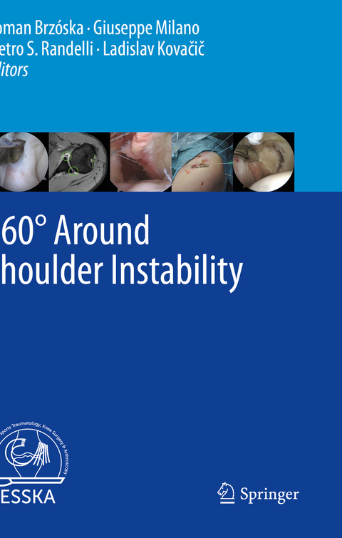 360° Around Shoulder Instability - 