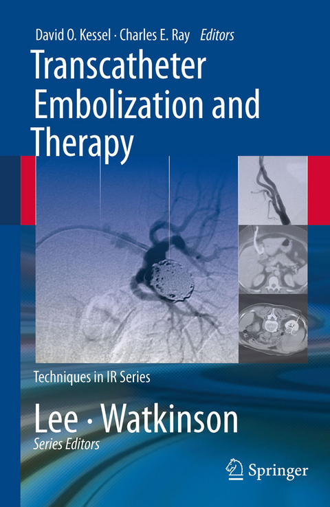 Transcatheter Embolization and Therapy - 
