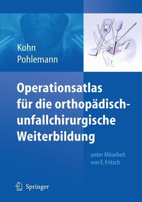 Operationsatlas für die orthopädisch-unfallchirurgische Weiterbildung - Dieter Kohn, Tim Pohlemann