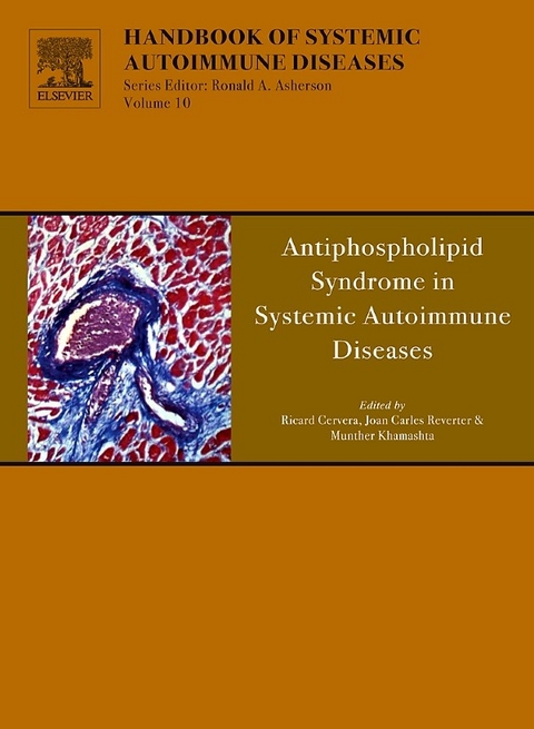 Antiphospholipid Syndrome in Systemic Autoimmune Diseases - 