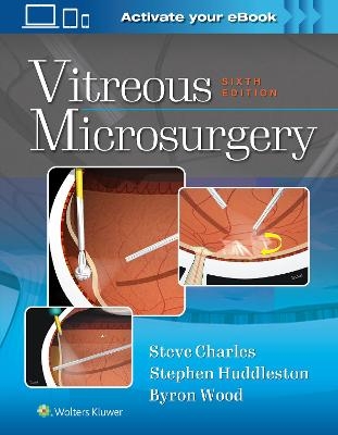 Vitreous Microsurgery - Steve Charles