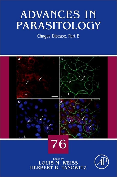 Chagas Disease - 