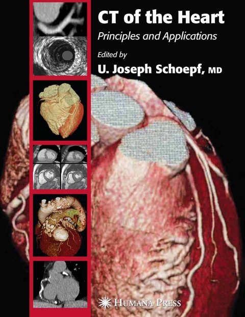 CT of the Heart - 