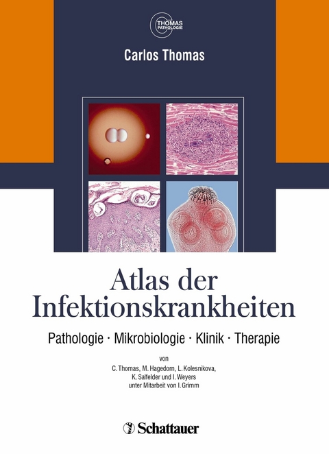 Atlas der Infektionskrankheiten -  Carlos Thomas,  Annette Cecetka-Thomas,  Renate Woicichowski
