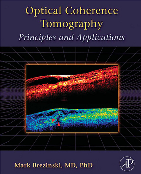 Optical Coherence Tomography -  Mark E. Brezinski