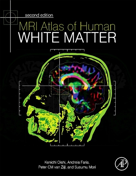MRI Atlas of Human White Matter -  Andreia V. Faria,  Susumu Mori,  Kenichi Oishi,  Peter C M van Zijl