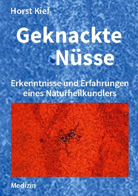 Geknackte Nüsse - Horst Kief