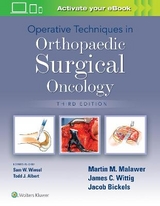 Operative Techniques in Orthopaedic Surgical Oncology - Malawer, Martin M.