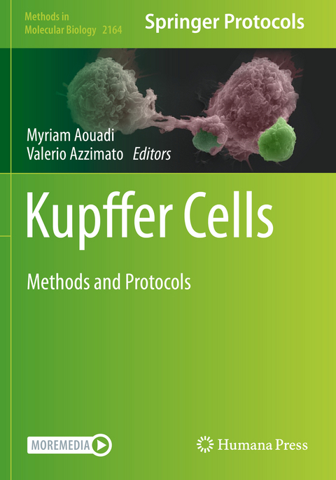 Kupffer Cells - 
