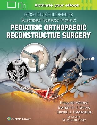 Boston Children's Illustrated Tips and Tricks in Pediatric Orthopaedic Reconstructive Surgery - 