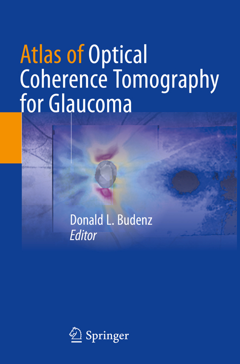 Atlas of Optical Coherence Tomography for Glaucoma - 