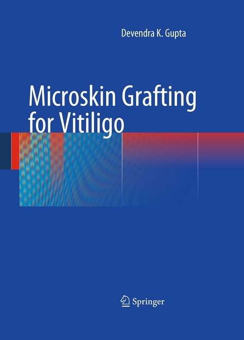 Microskin Grafting for Vitiligo -  Devendra K. Gupta