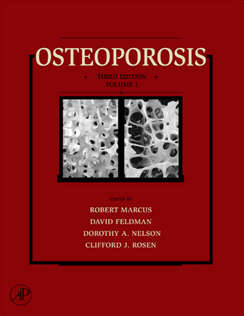 Osteoporosis - 