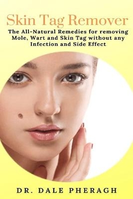 Skin Tag Remover - Dr Dale Pheragh