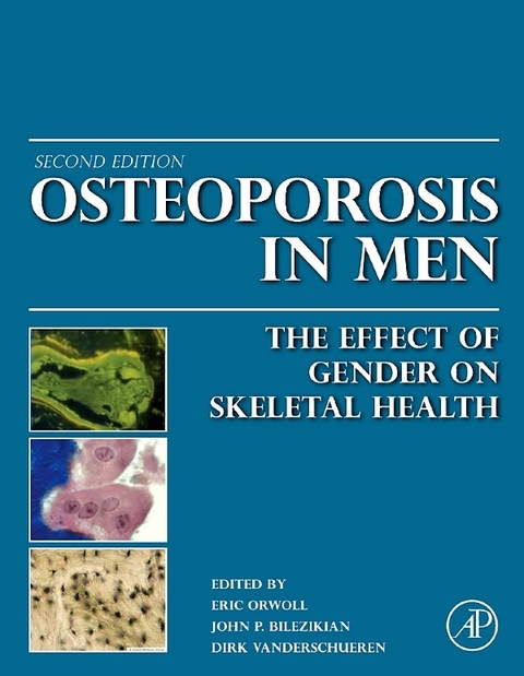 Osteoporosis in Men - 